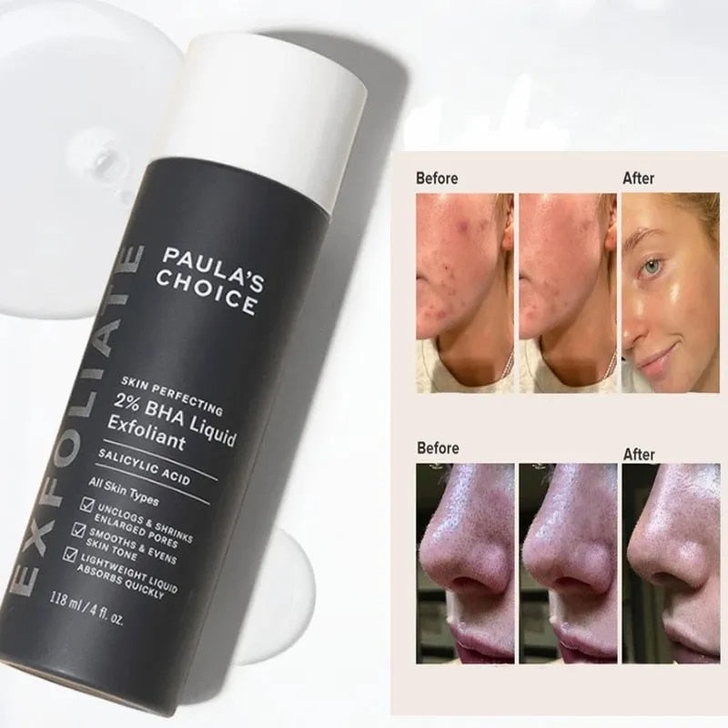 Paula's Choice SKIN PERFECTING 2% Salicylic Acid Liquid Exfoliant, Facial Polish for Enlarged Pores, Wrinkles & Fine Lines, Suitable for Blackhead-Prone Skin, Fragrance-Free 118ML